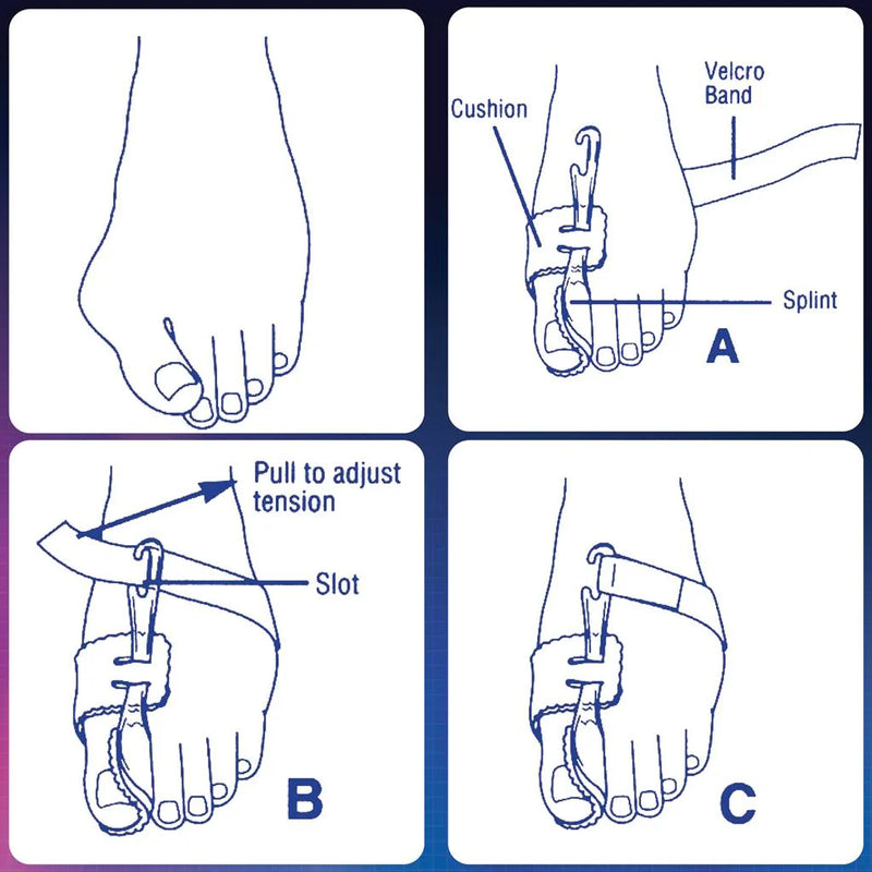 Load image into Gallery viewer, PediFix Nighttime Bunion Regulator - Left, Large