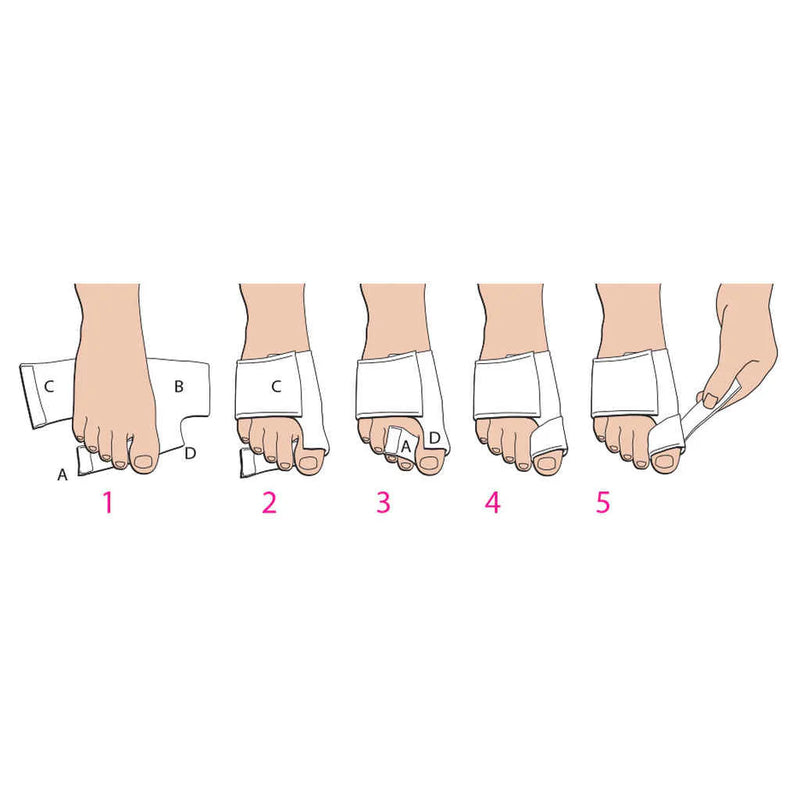 Load image into Gallery viewer, PediFix Bunion Soft Splint Left Foot

