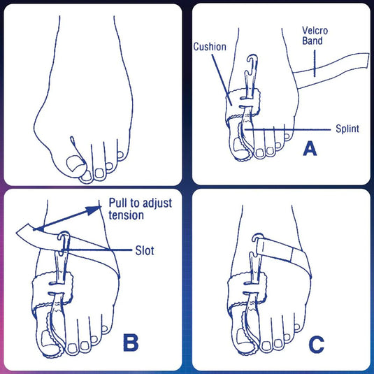 PediFix Nighttime Bunion Regulator - Left, Medium